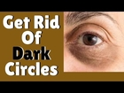 How To Get Rid Of Dark Circles | Put An End To Dark Circles Under Eyes