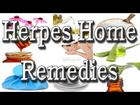 Home Remedies For Herpes - Cure Herpes With 21 Natural Cures !