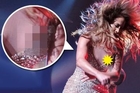 Jennifer Lopez Suffers A Nipslip In Public !!